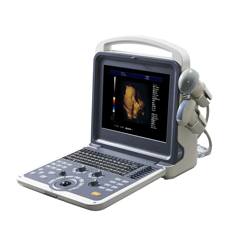 Ультразвуковой сканер ПК медицинский цветной доплеровский ультразвуковой прибор